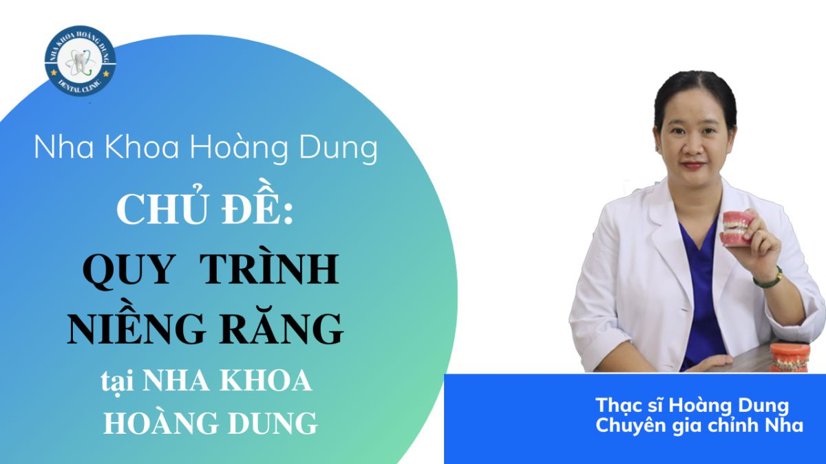 QUY TRÌNH NIỀNG RĂNG tại NHA KHOA HOÀNG DUNG Bắc Ninh